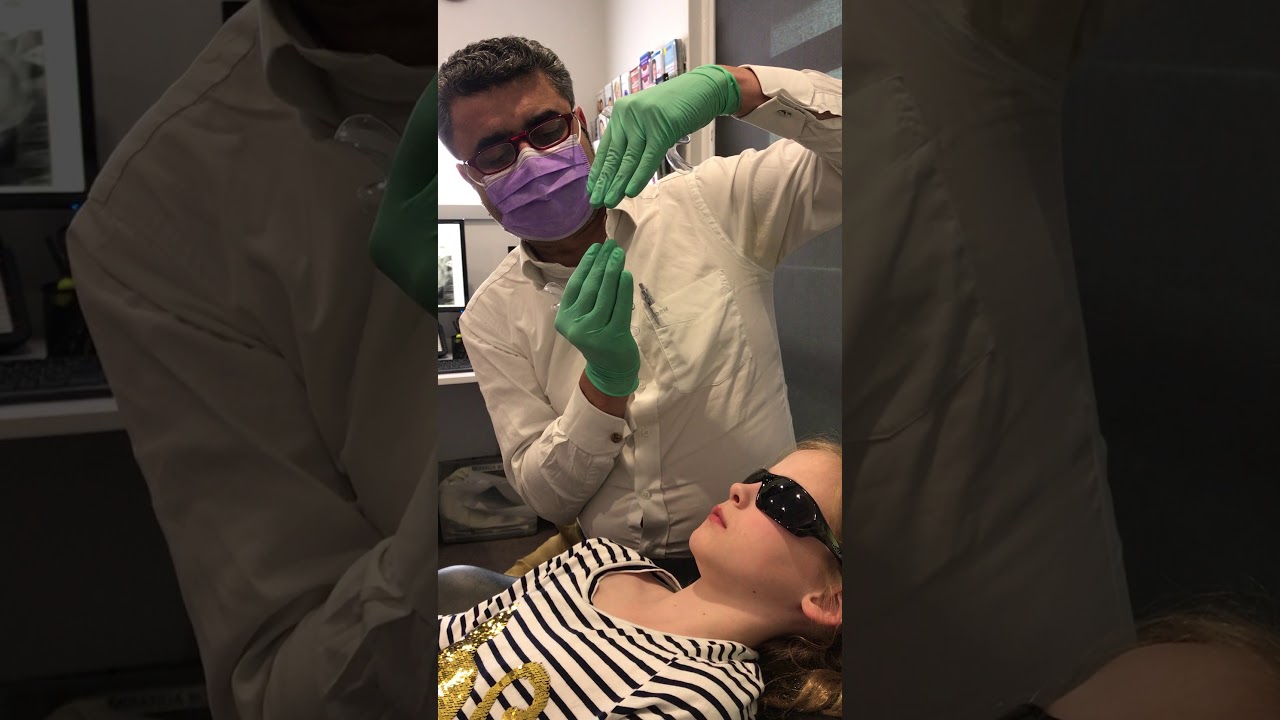 Narrow Palate Tongue Thrust and Class II Malocclusion in Orthodontics