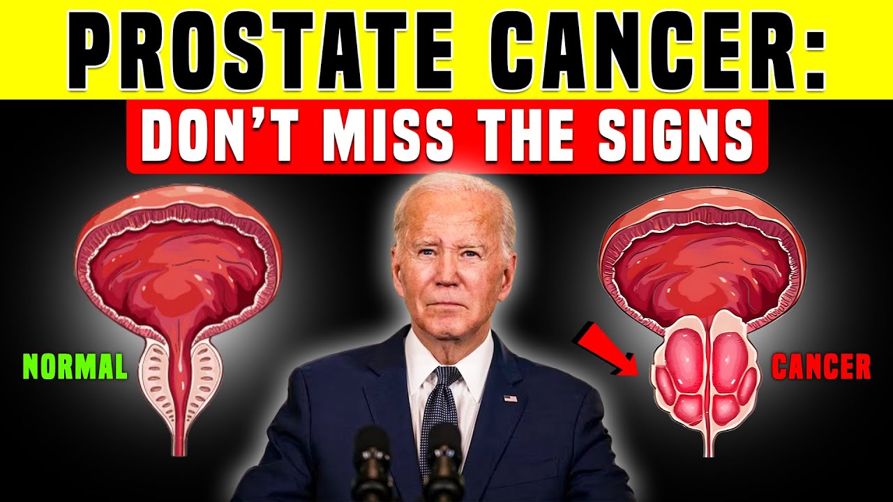 Joe Biden’s Prostate Cancer Is a Wake Up Call for All Men Over 60