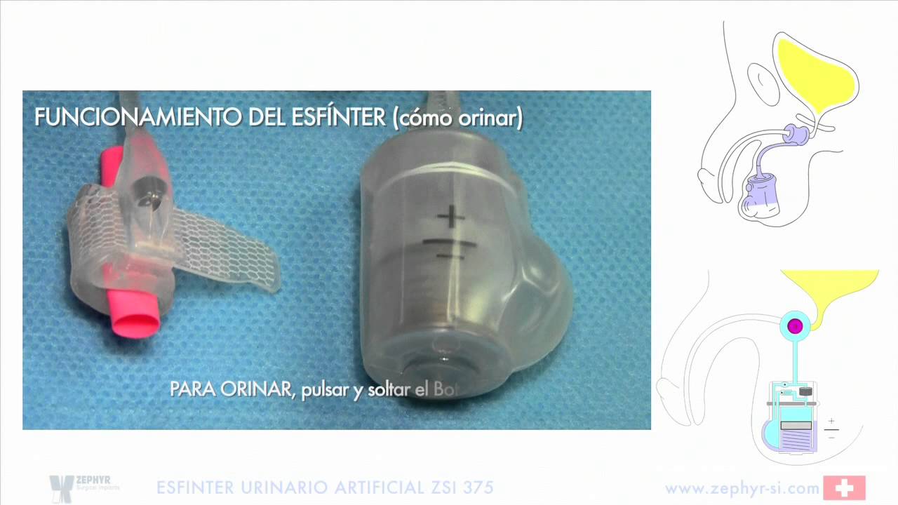 ZSI 375 HOW TO URINATE SPANISH