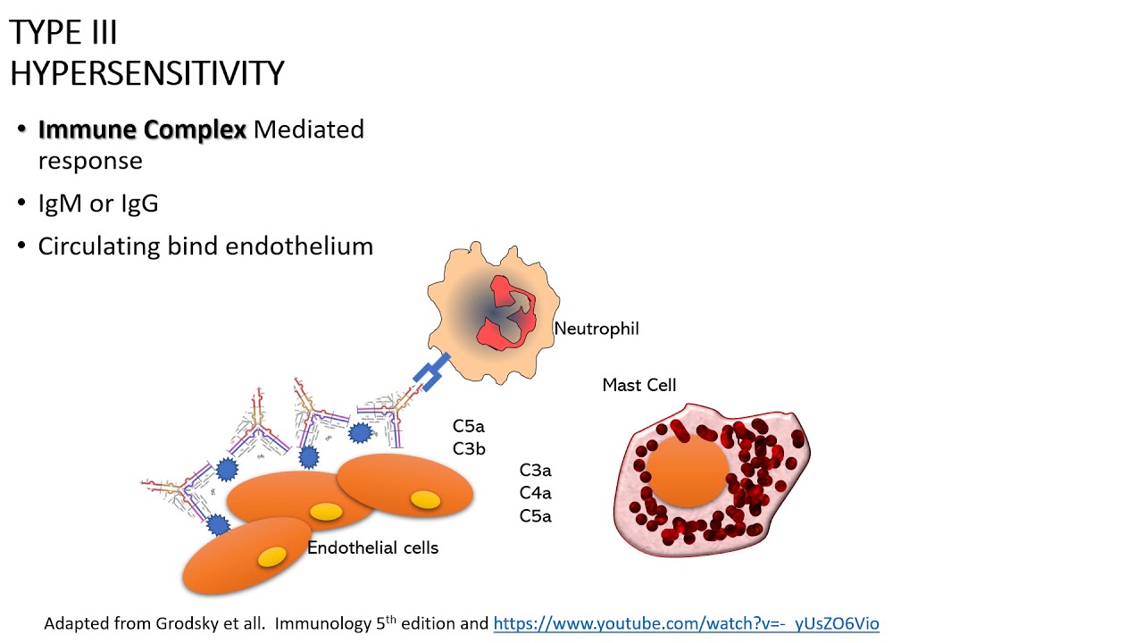 Immune response: Type 3 Hypersensitivity response