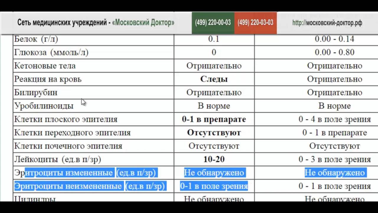 Анализ мочи расшифровываем сами
