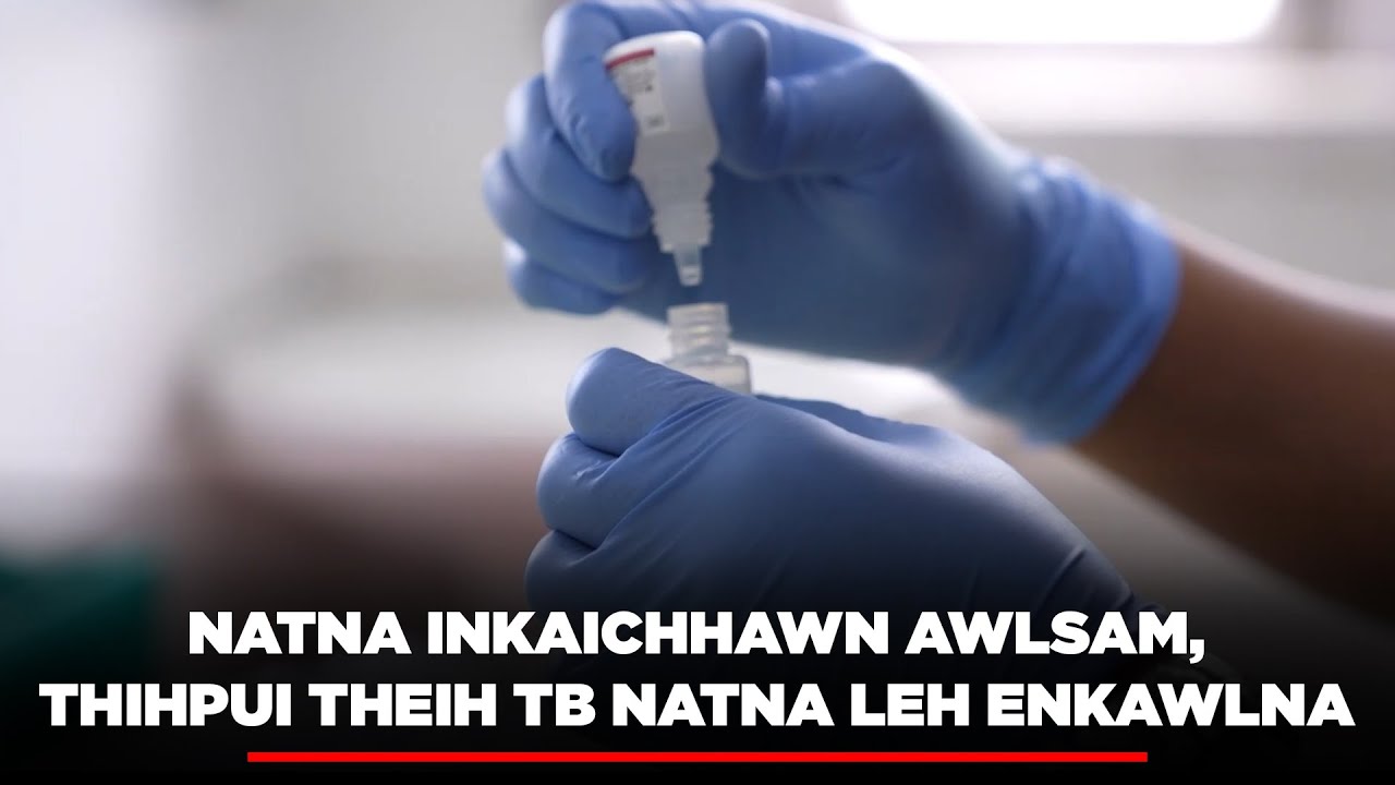 Natna inkaichhawn awlsam, thihpui theih TB natna leh enkawlna