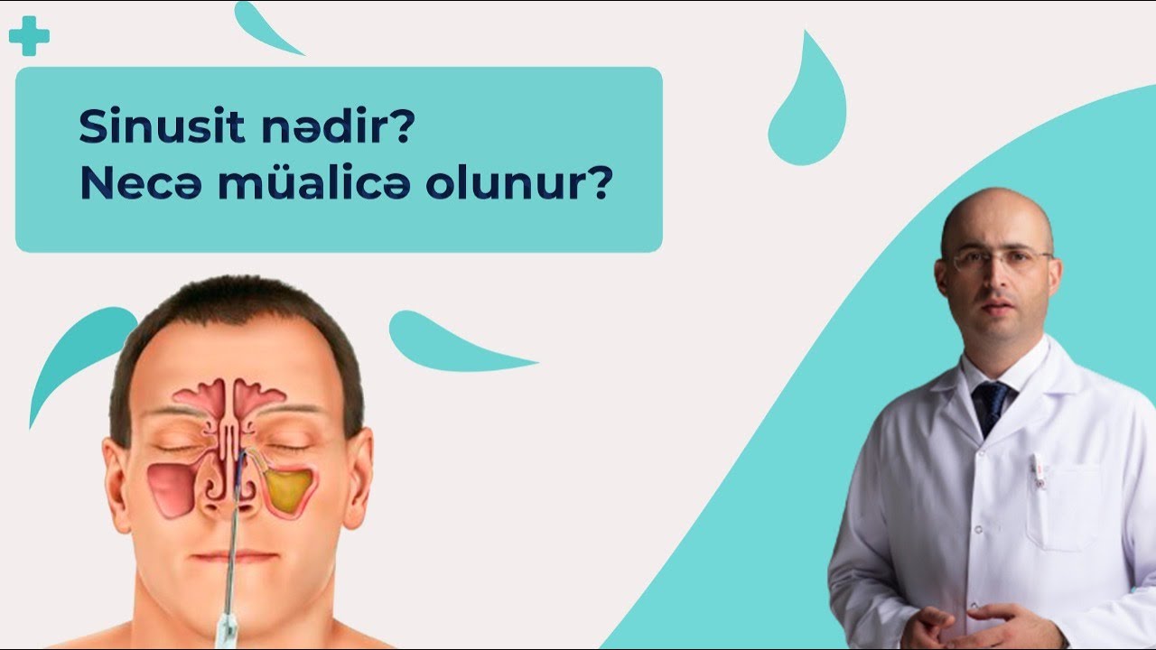 Uzman Dr Elnur Əkbərov – Sinusit nədir? Necə müalicə olunur?