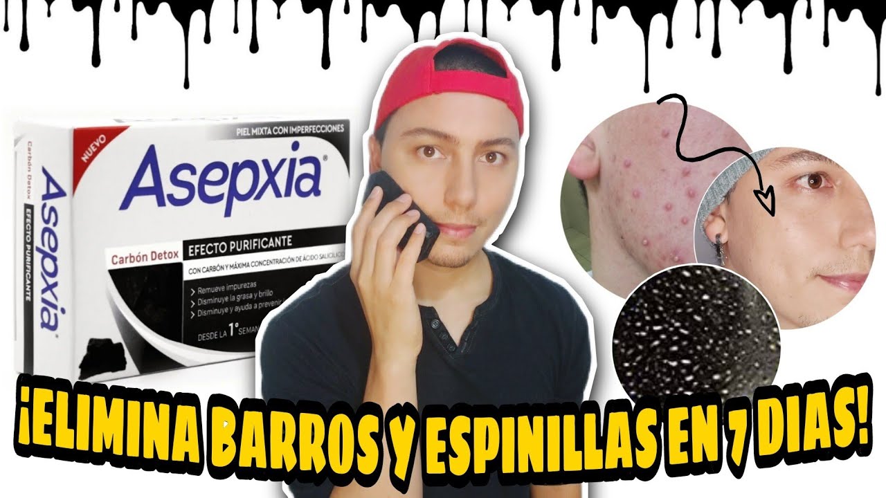 ¡ELIMINA ACNÉ en 1 SEMANA con $35 pesos! ✅ Probando JABON ASEPXIA CARBÓN DETOX ¿FUNCIONA?