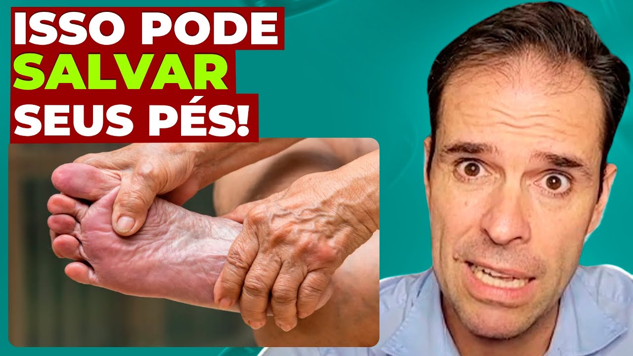 TUDO que você precisa saber sobre os pés do diabético!