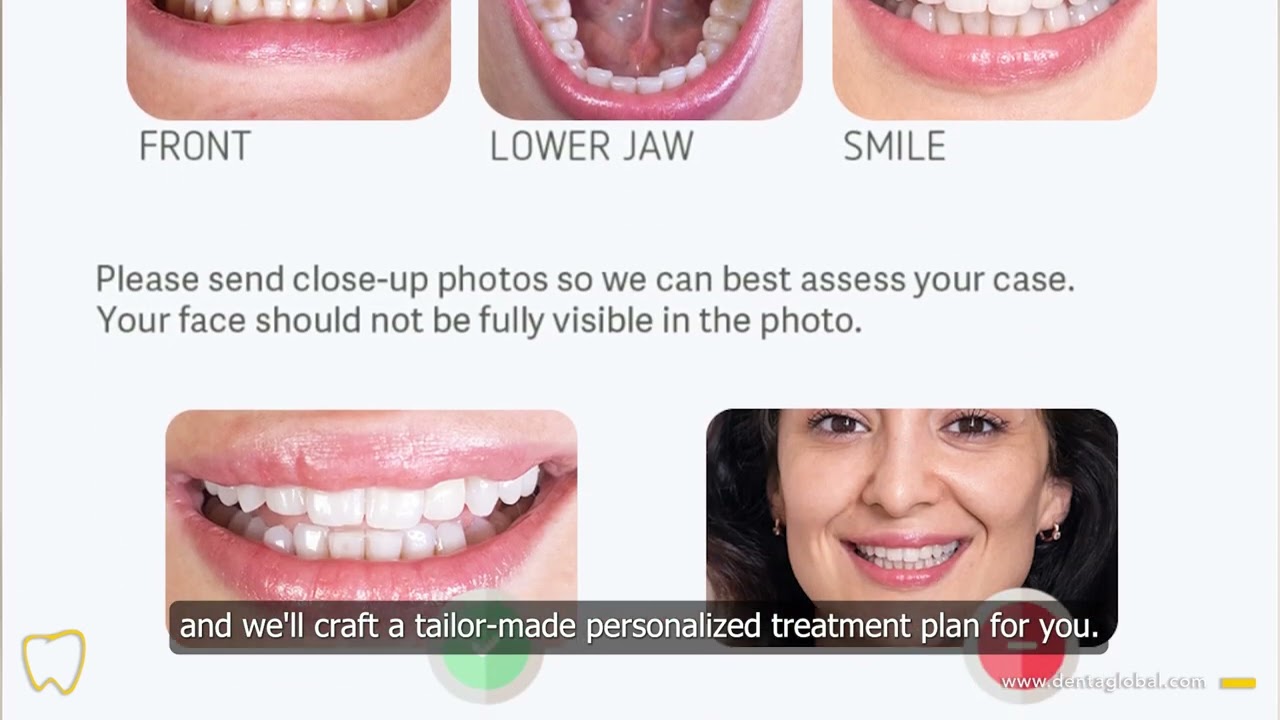 Interested in dental treatment abroad? Get in touch with our team for further information!