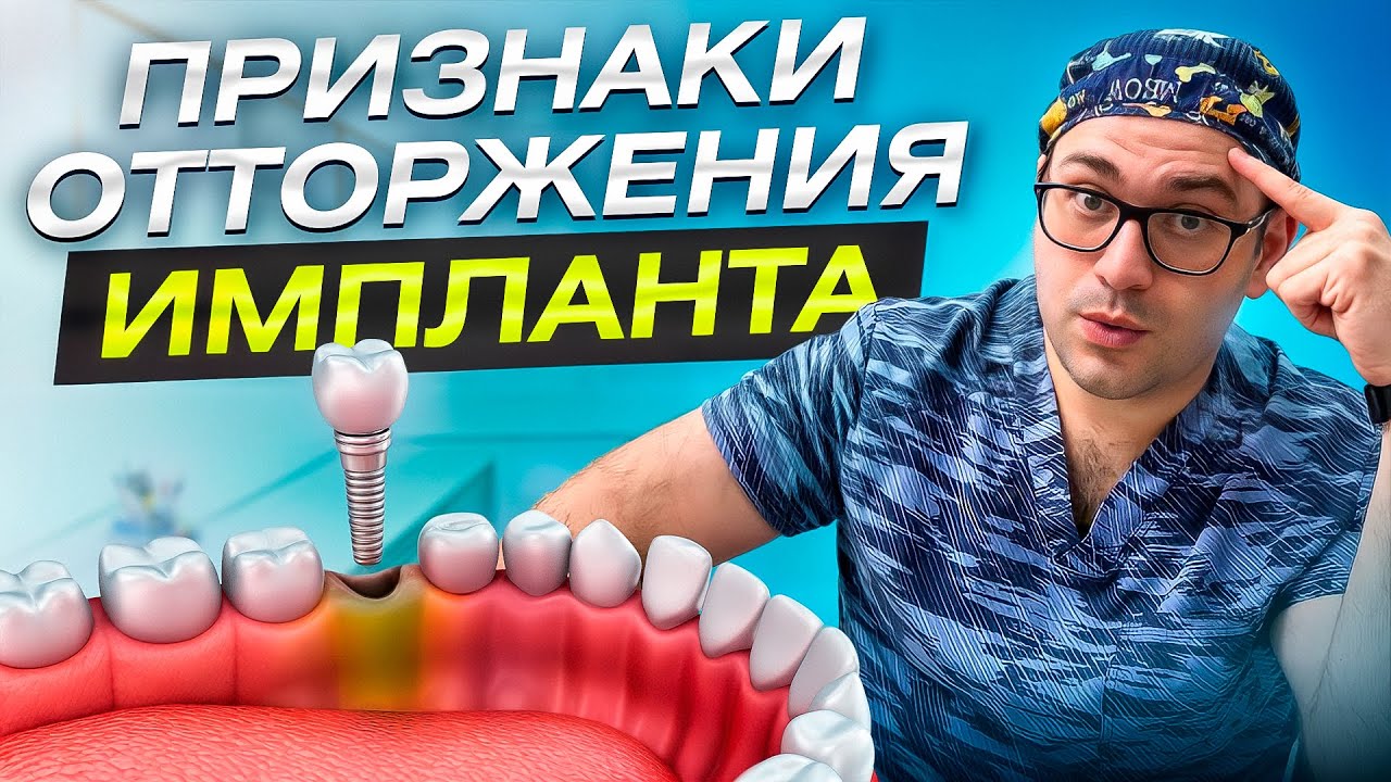 Признаки отторжения импланта - как распознать и что делать