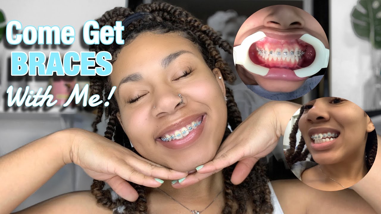 GETTING BRACES Vlog!| KDiani