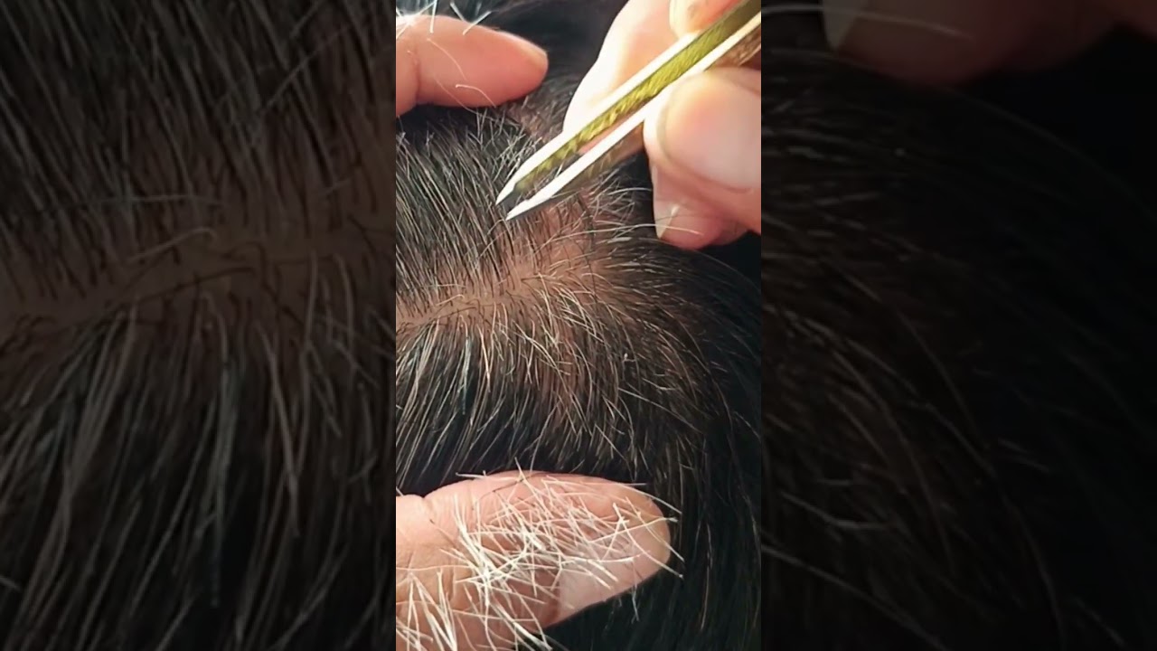 Most satisfying white hair removal 1.17#relaxing #satisfying #editing