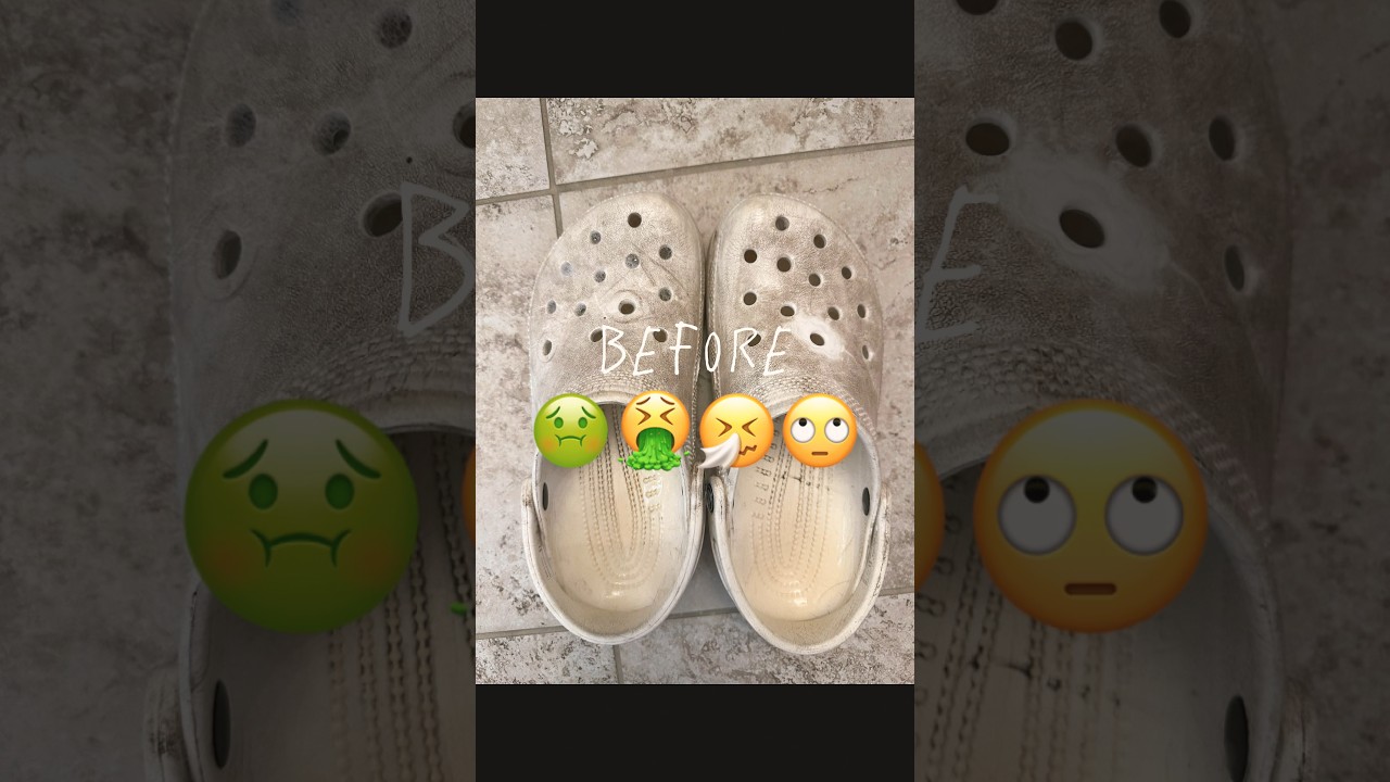 Cleaning nasty crocs🤢🤧🤮✋