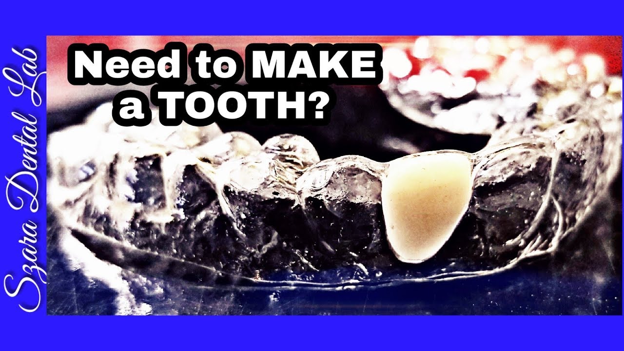 Invisible Retainer Pontic Tooth Lesson #97 Szara Dental