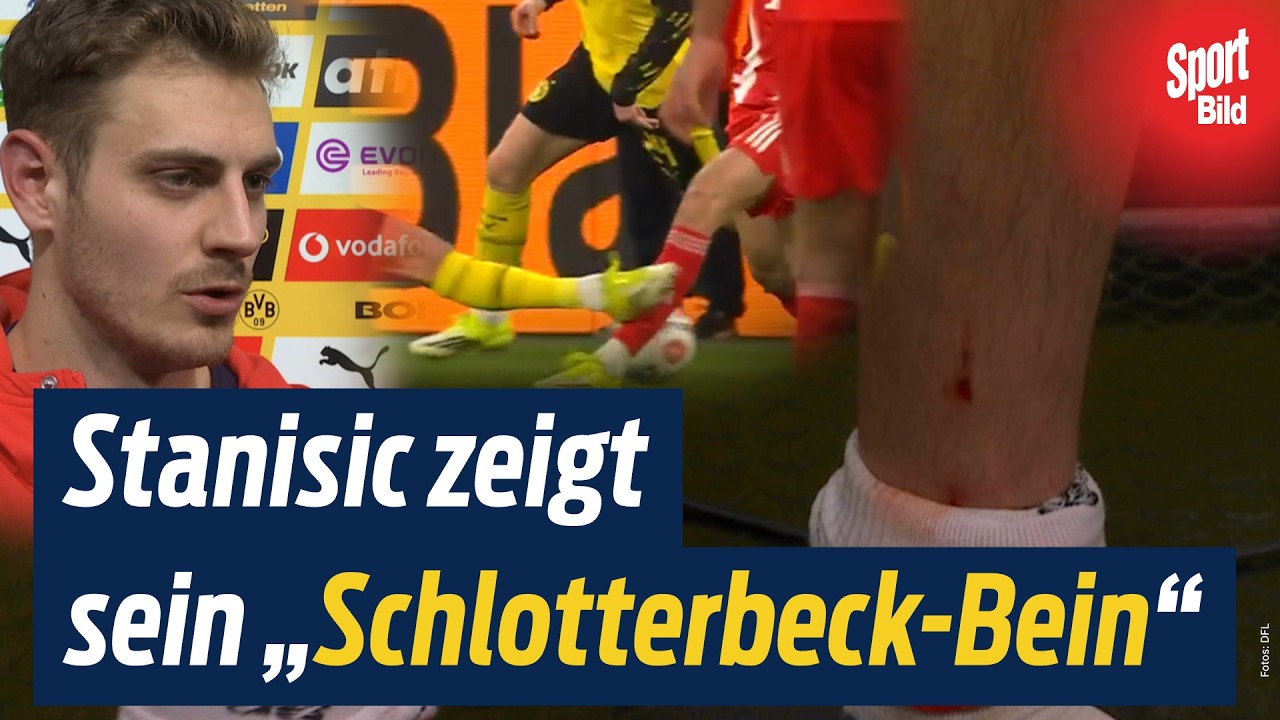 Rot für den BVB? Schlotterbeck, Stanisic, Kompany & Kovac zum Spiel