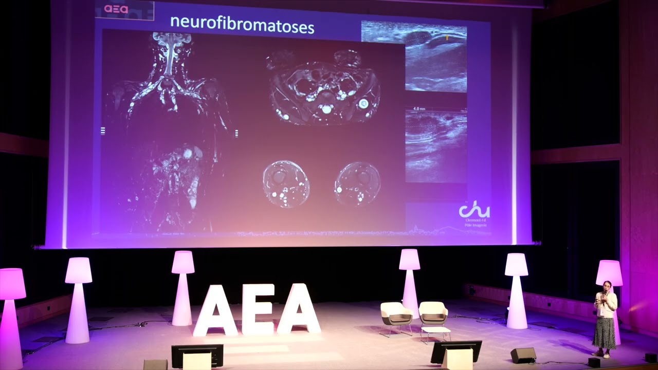 AEA 2024 - Imagerie des nerfs lésés