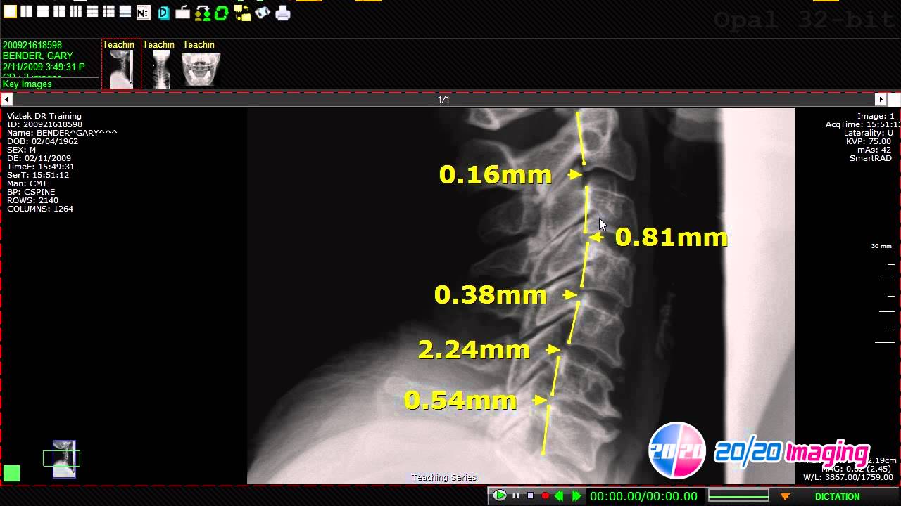 20 20 Imaging Opal Rad Chiropractic Software Tools