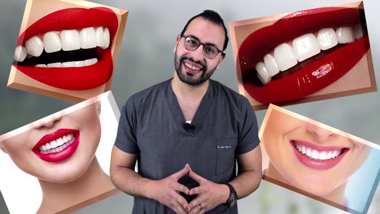 ابتسامة هوليود الجزء الأول ، فوائدها وأضرارها ...