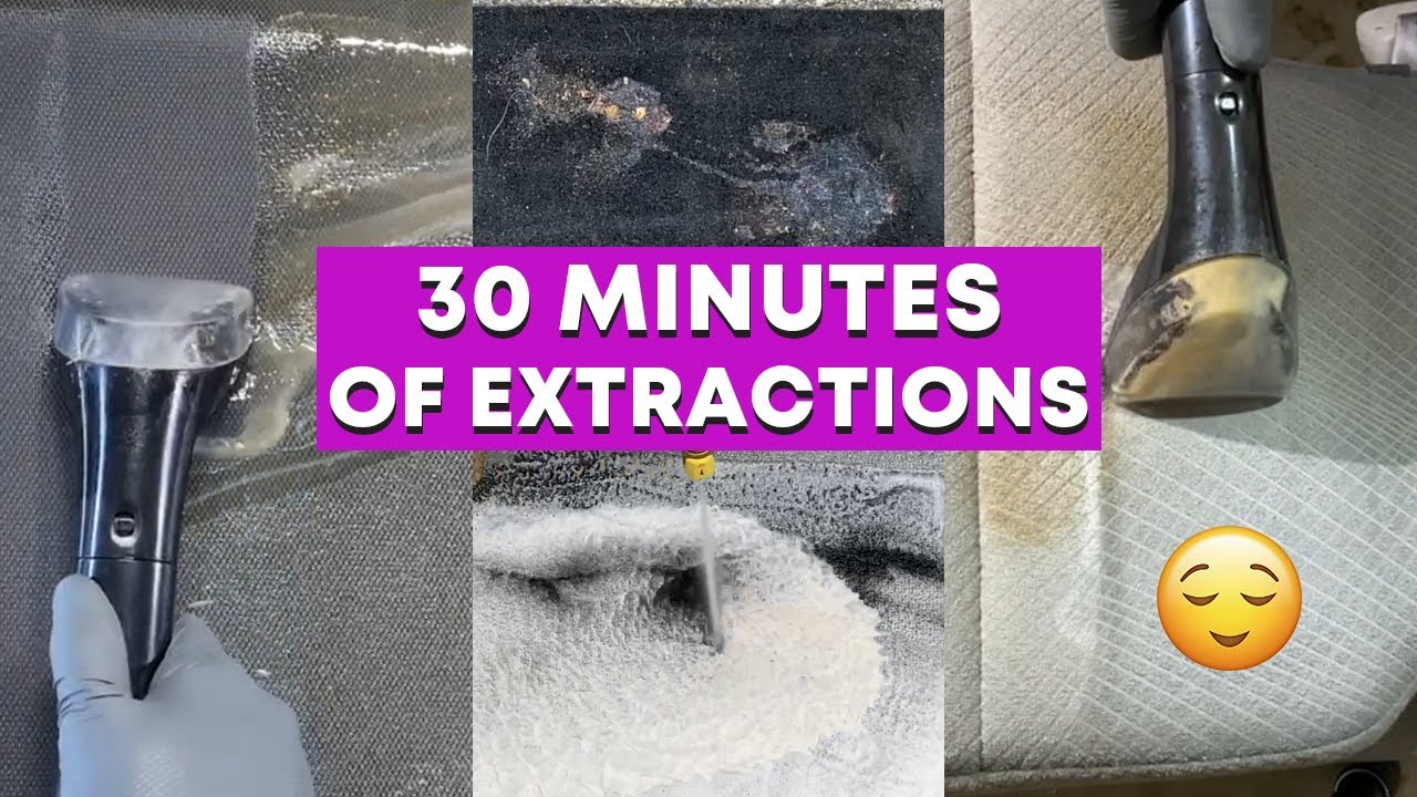 SATISFYING Extraction Compilation | DISGUSTING Deep Cleans