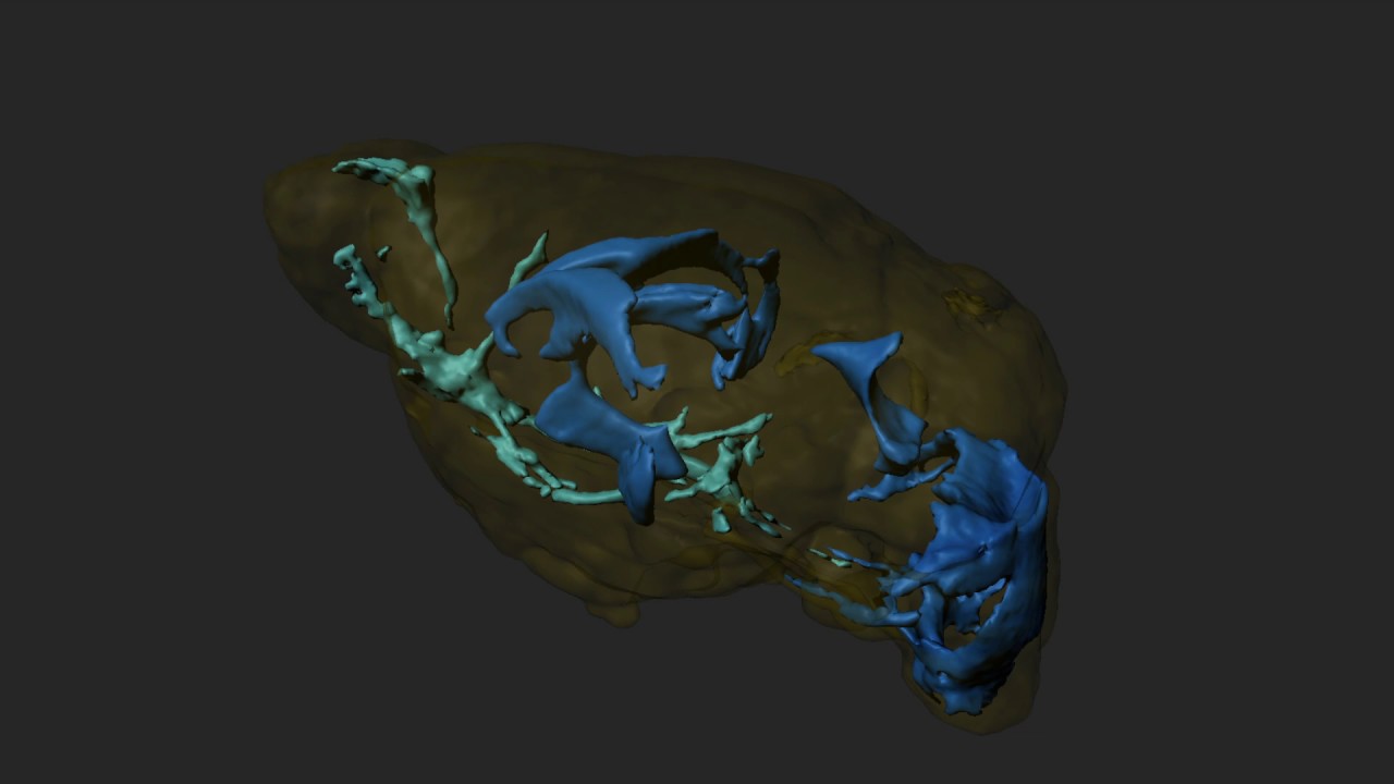 Mouse brain 3D volumetry with 9.4T preclinical MRI