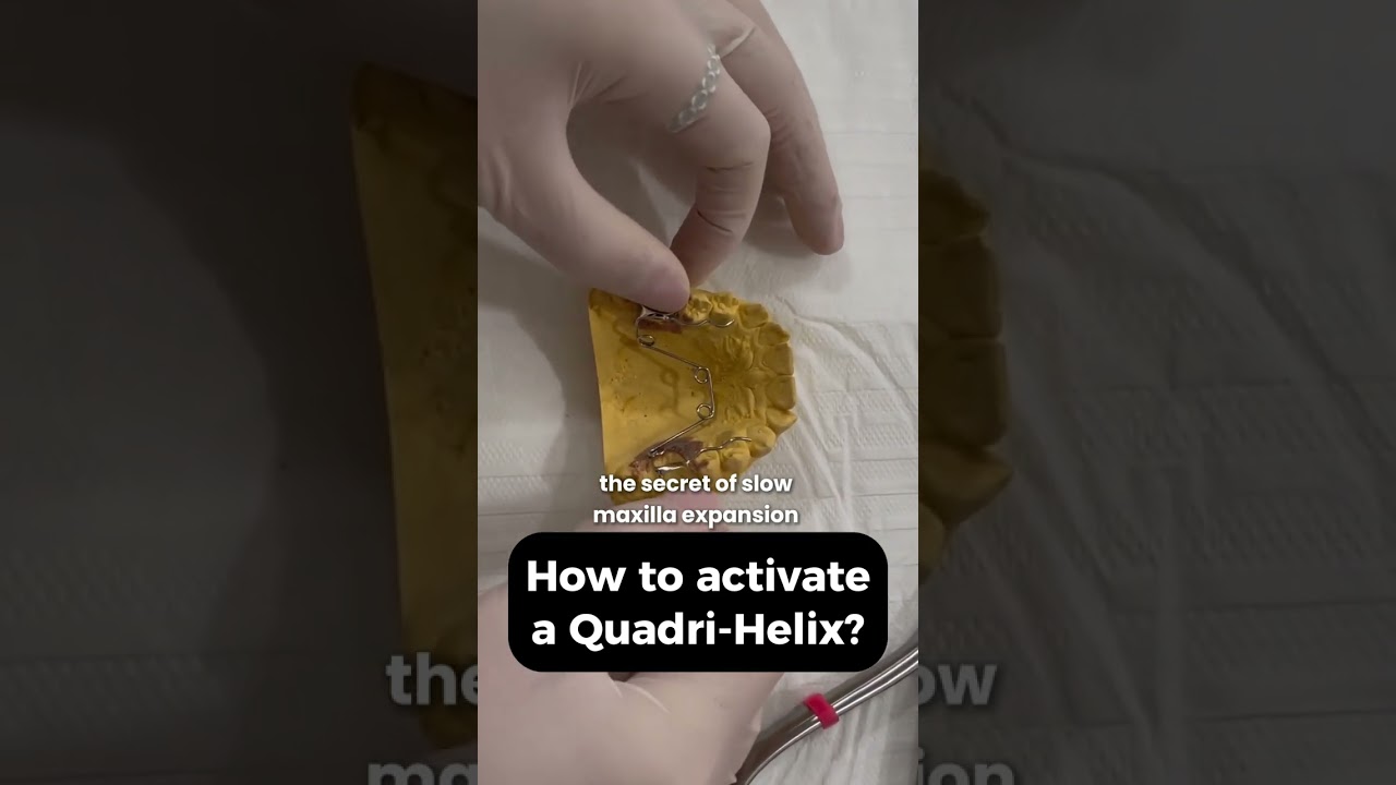 How to activate a Quadri-Helix?