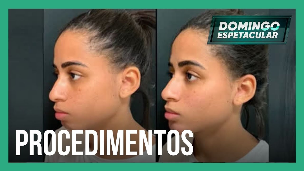Adolescentes buscam a perfeição e fazem procedimentos estéticos