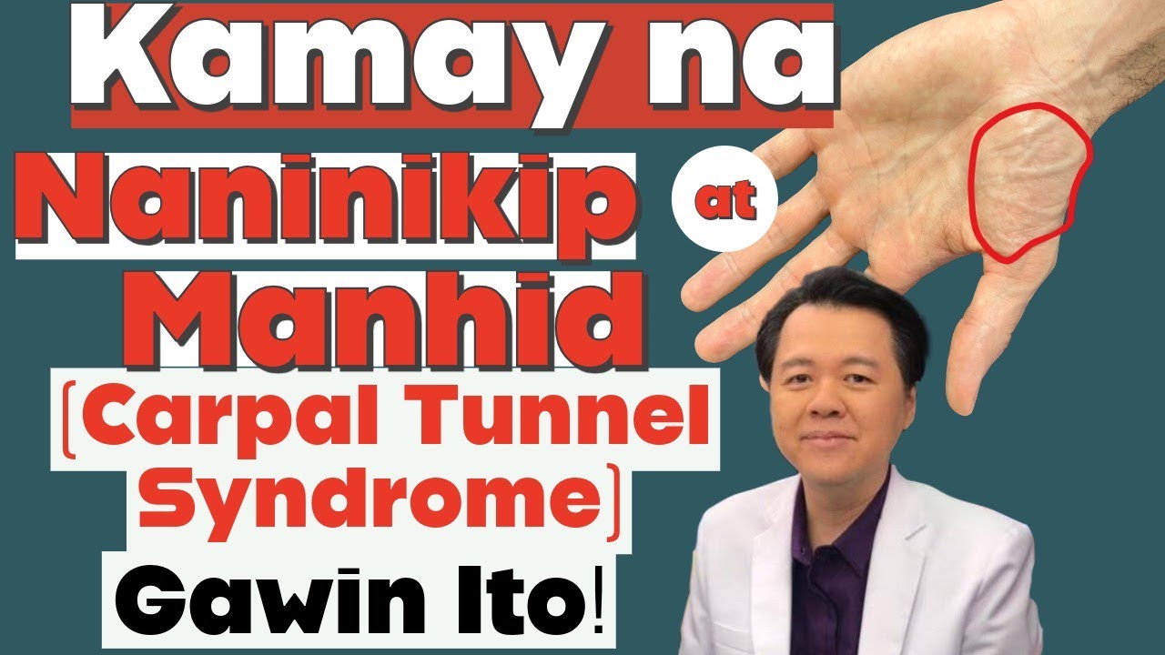 Kamay na Naninikip at Namamanhid (Carpal Tunnel Syndrome): Relief Exercises na Puwede Mong Gawin.