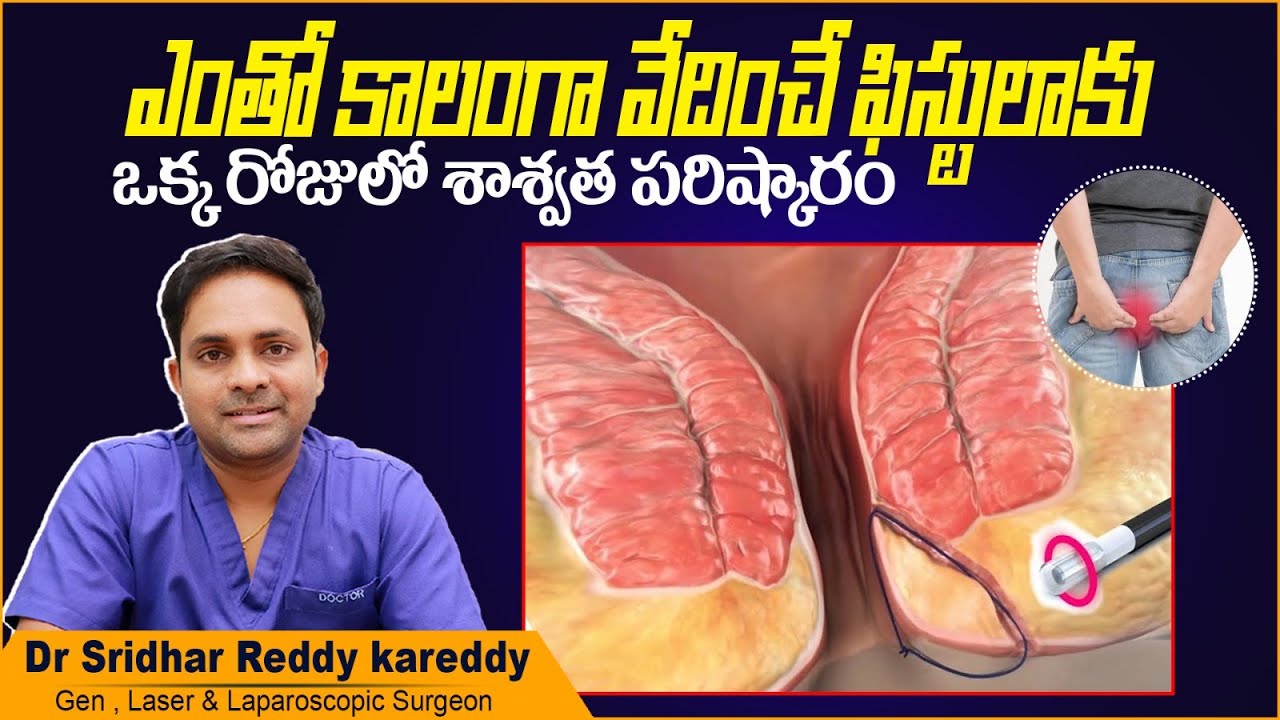 How to Cure Fistula Permanently? | Laser Treatment for Fistula in Telugu | Treatment Range Hospital