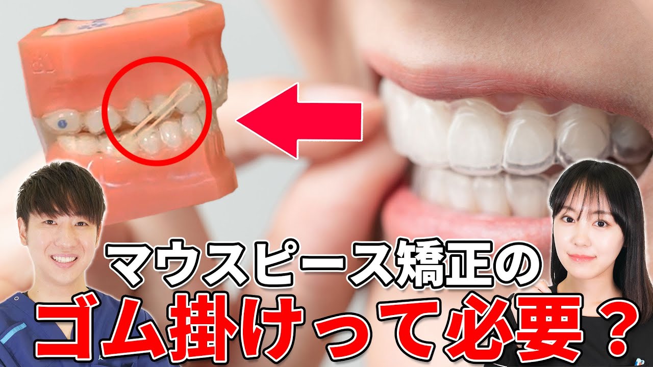 インビザラインの矯正用ゴム掛けは必要？その役割や方法について解説【顎間ゴム】