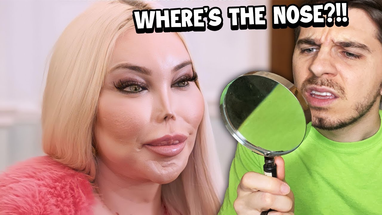 She Had 100+ Surgeries 👁️👃👁️ But Lost Her Nose...
