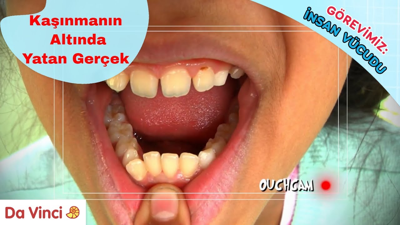 Sürekli Kaşınmak Ne Anlama Gelir ❓🤔| Görevimiz: İnsan Vücudu | Da Vinci TV Türkiye