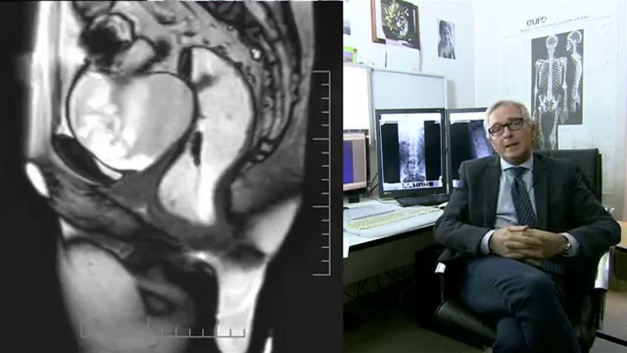 Defecografia Dottor Giacomo Suma