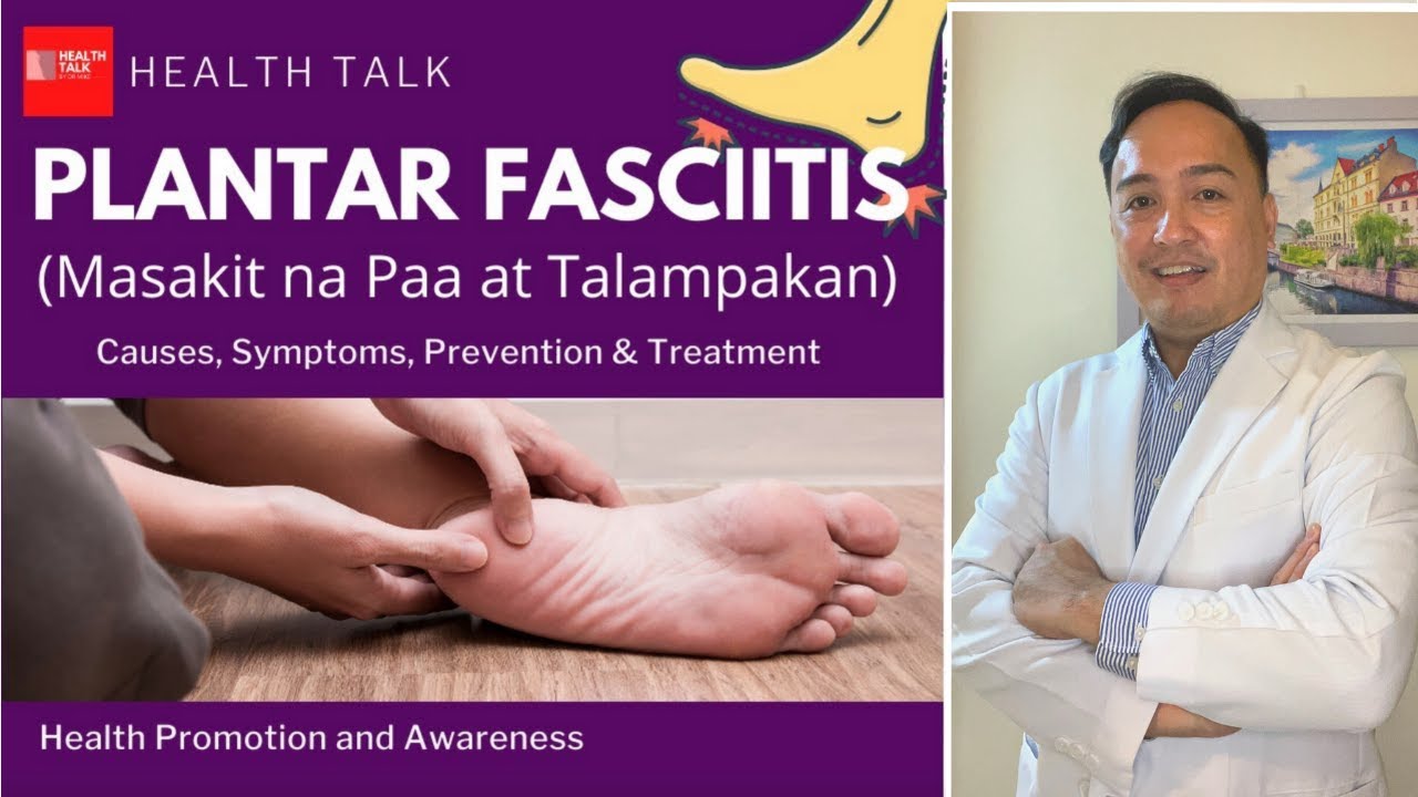 Plantar Fasciitis (Masakit na paa at talampakan): Causes, Symptoms, Treatment and Prevention