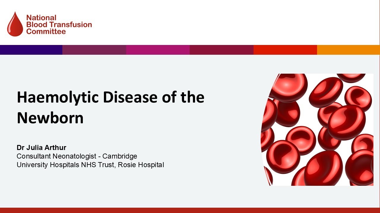 Haemolytic Disease of the Newborn