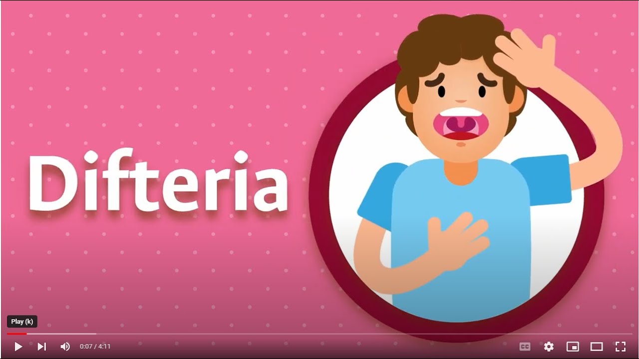 Conozca qué es la difteria y cómo se puede prevenir