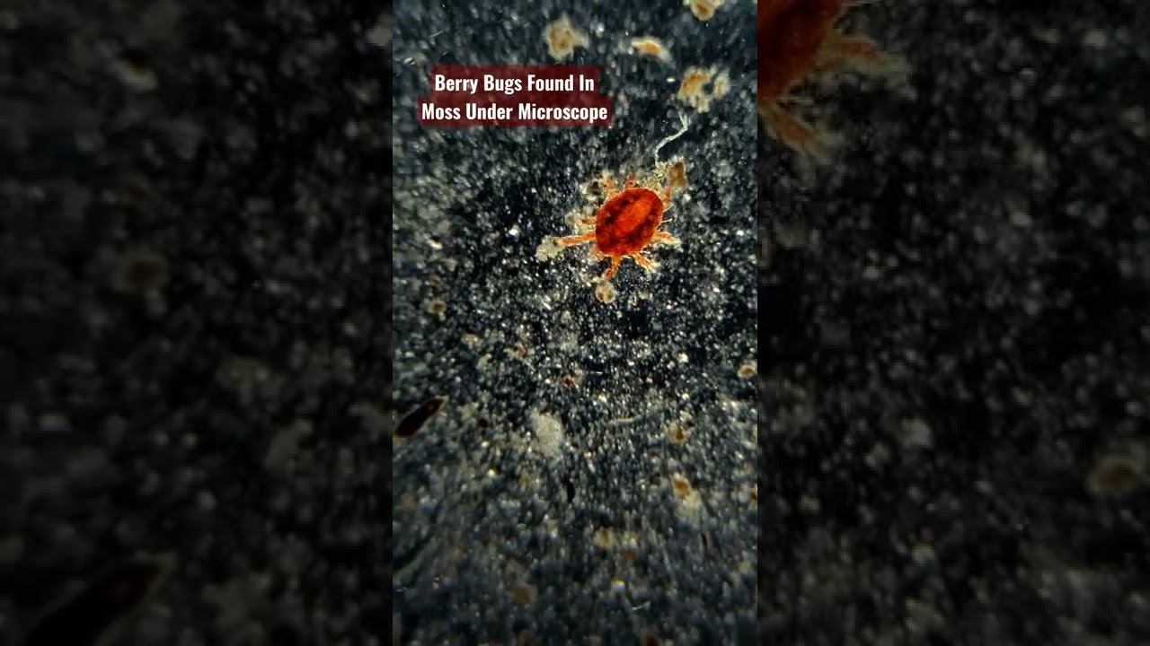 BERRY BUGS AKA CHIGGERS UNDER MICROSCOPE