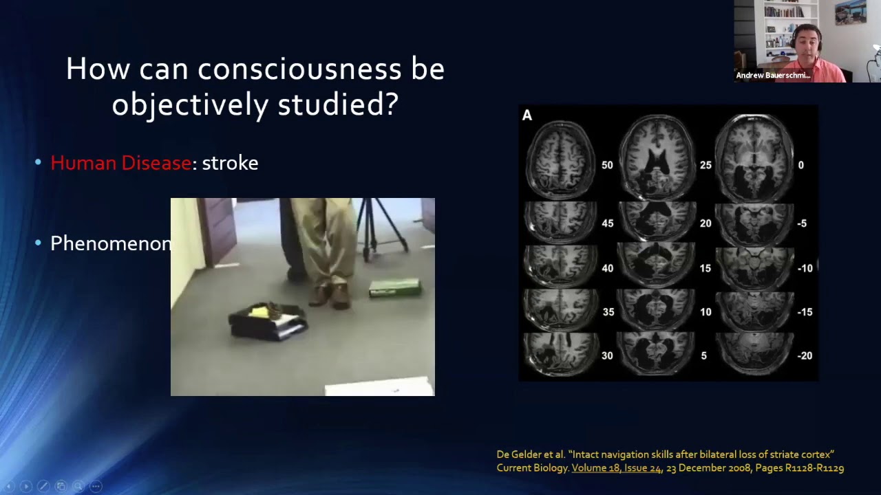 Neurology Lectures: Coma and other disorders of consciousness with Dr. Bauerschmidt