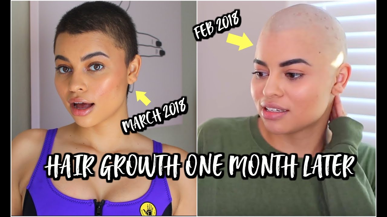 HAIR GROWTH UPDATE! 1 MONTH (+ products I used )