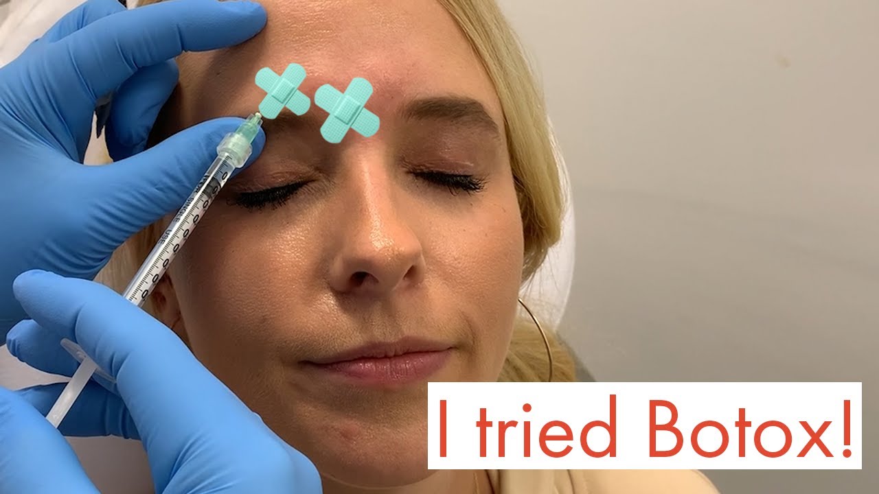 I Try Botox for the First Time! 😬| Cosmo Video Diaries | Cosmopolitan