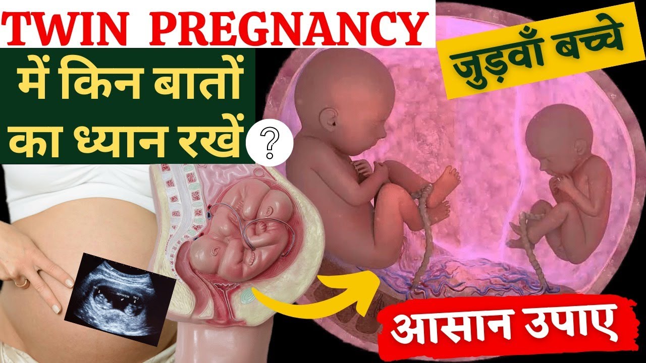 Twin Pregnancy में किन बातों का ध्यान रखें ? आसान उपाए - Youtube Mom