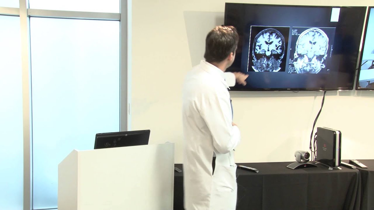 Keep Memory Alive - Mild Cognitive Impairment - What Does IT Mean-What Can We DO About It?