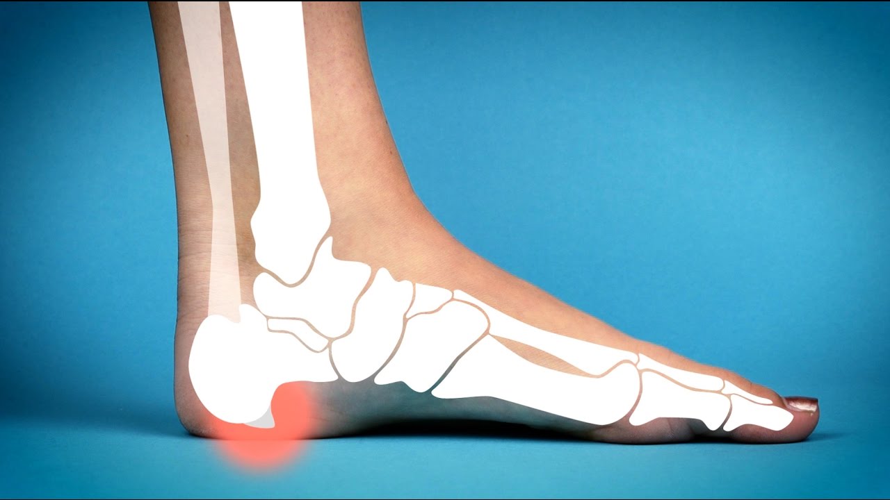 Two aids for heel spurs