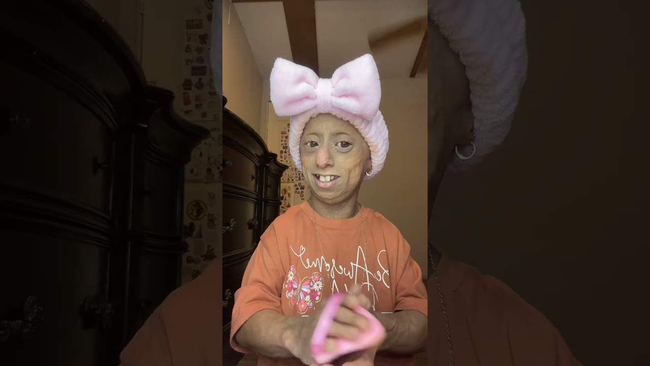 GRWW🤍 It is a very long video but I think it is necessary to watch it to the end.  #grwm #progeria