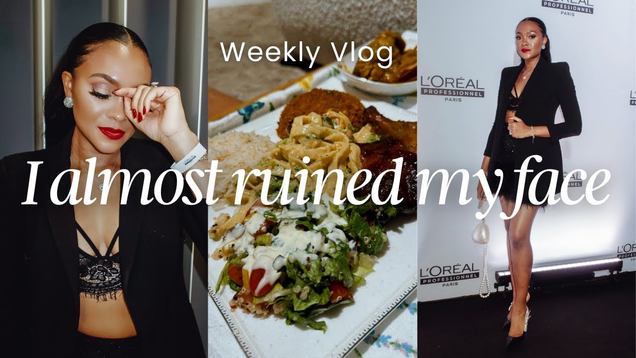 MY FACE GOT BURNT | 17 AGAIN | SURPRISE BIRTHDAY DINNER | L'OREAL PRODUCT LAUNCH | VLOG