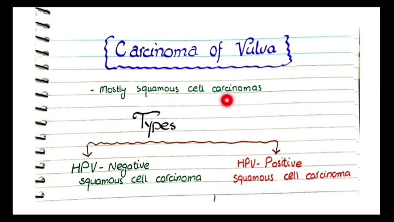 Carcinoma Of Vulva | Pathology