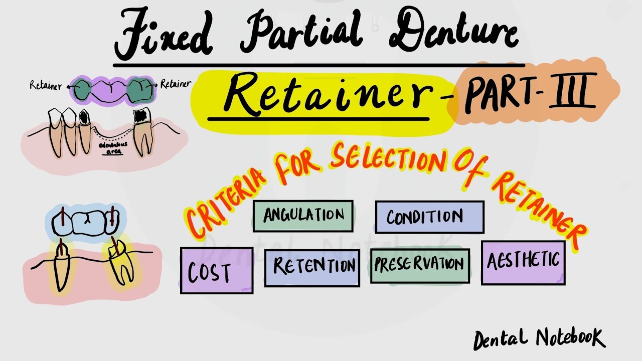 Criteria for selection of retainer (Fixed Partial Denture ) part 3
