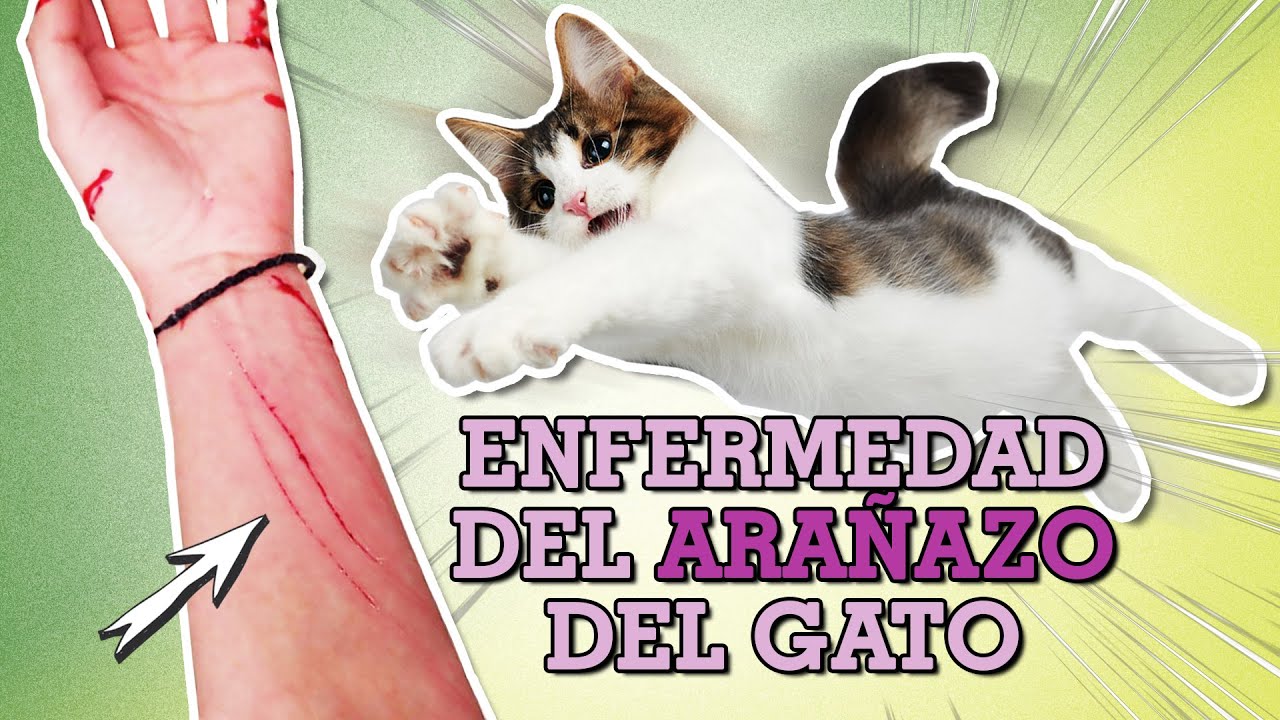 Enfermedad del ARAÑAZO del GATO 🐱👱👩 | ¿Afecta a gatos y a humanos? ¿Cómo se transmite?