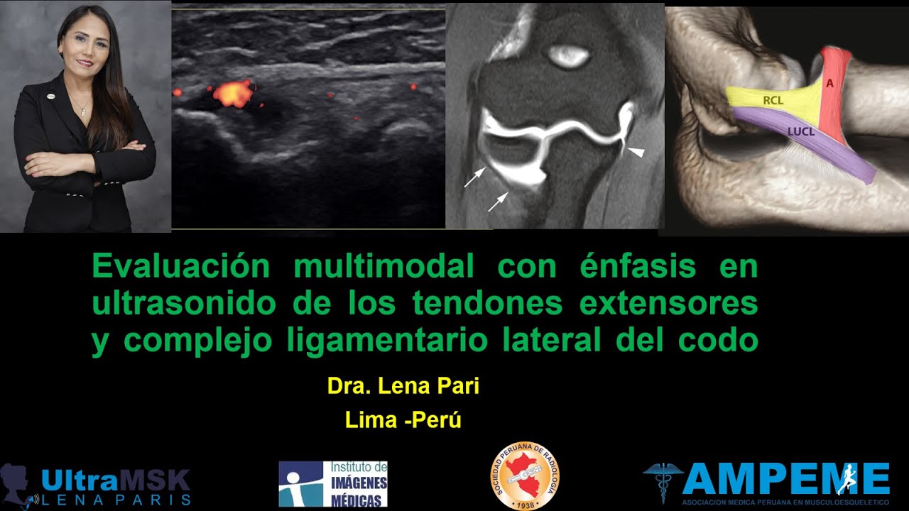 Como evaluar los tendones extensores y el complejo ligamentario lateral del codo. Dra. Lena Pari