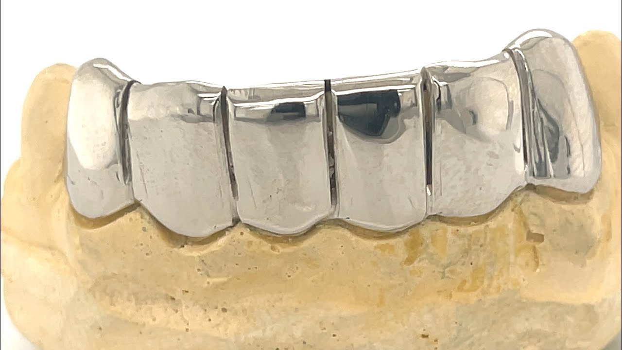 6pc White gold perm bottom grillz | Seattle Gold Grills!