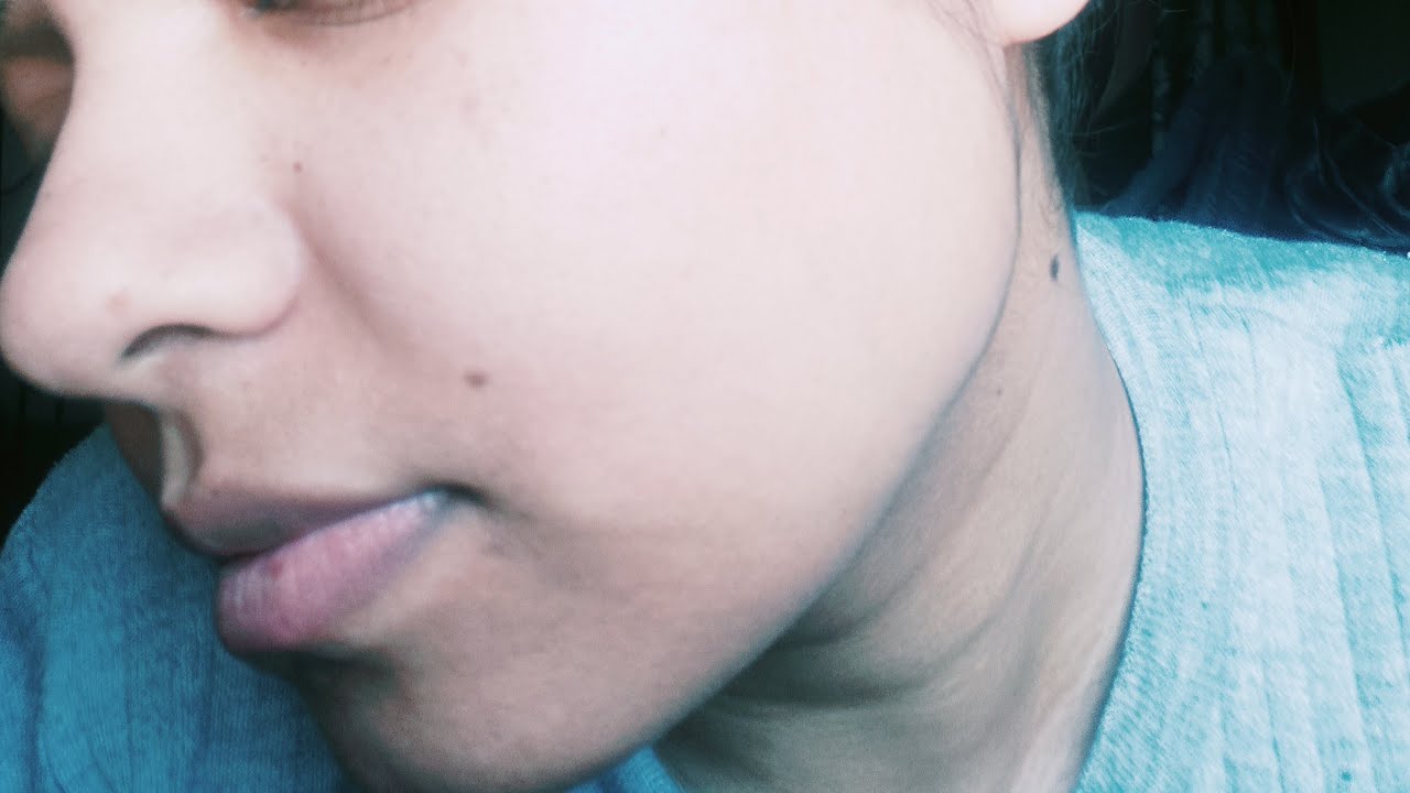 Remove facial hair #facialhairremovalforwomen. How to remove facial hair 