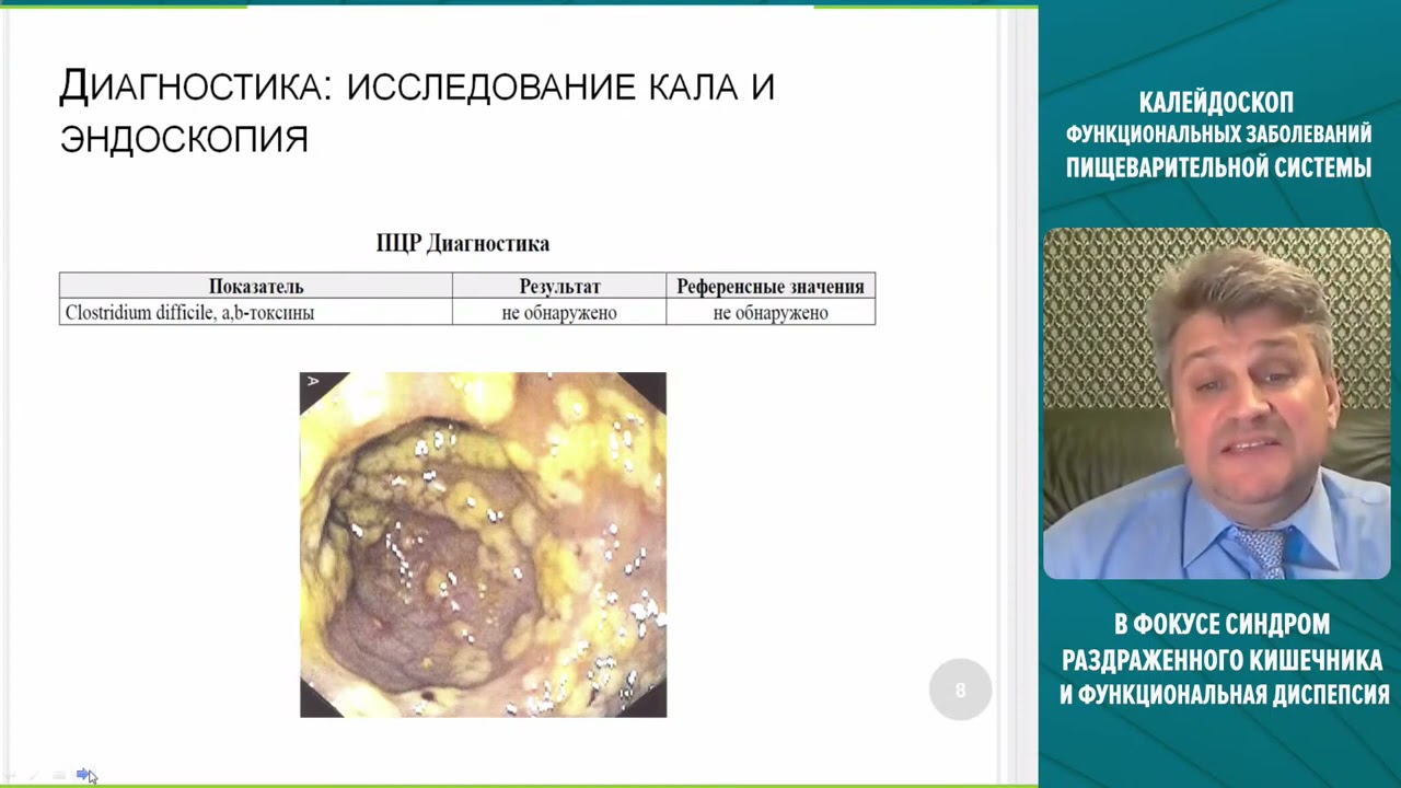 Профилактика антибиотикассоциированных заболеваний кишечника