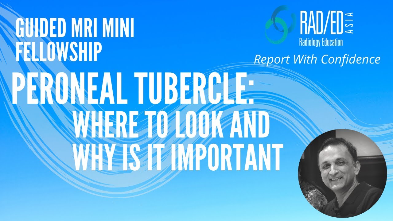 MRI ANKLE: HOW TO IDENTIFY THE PERONEAL TUBERCLE & RETROTROCHLEAR EMINENCE