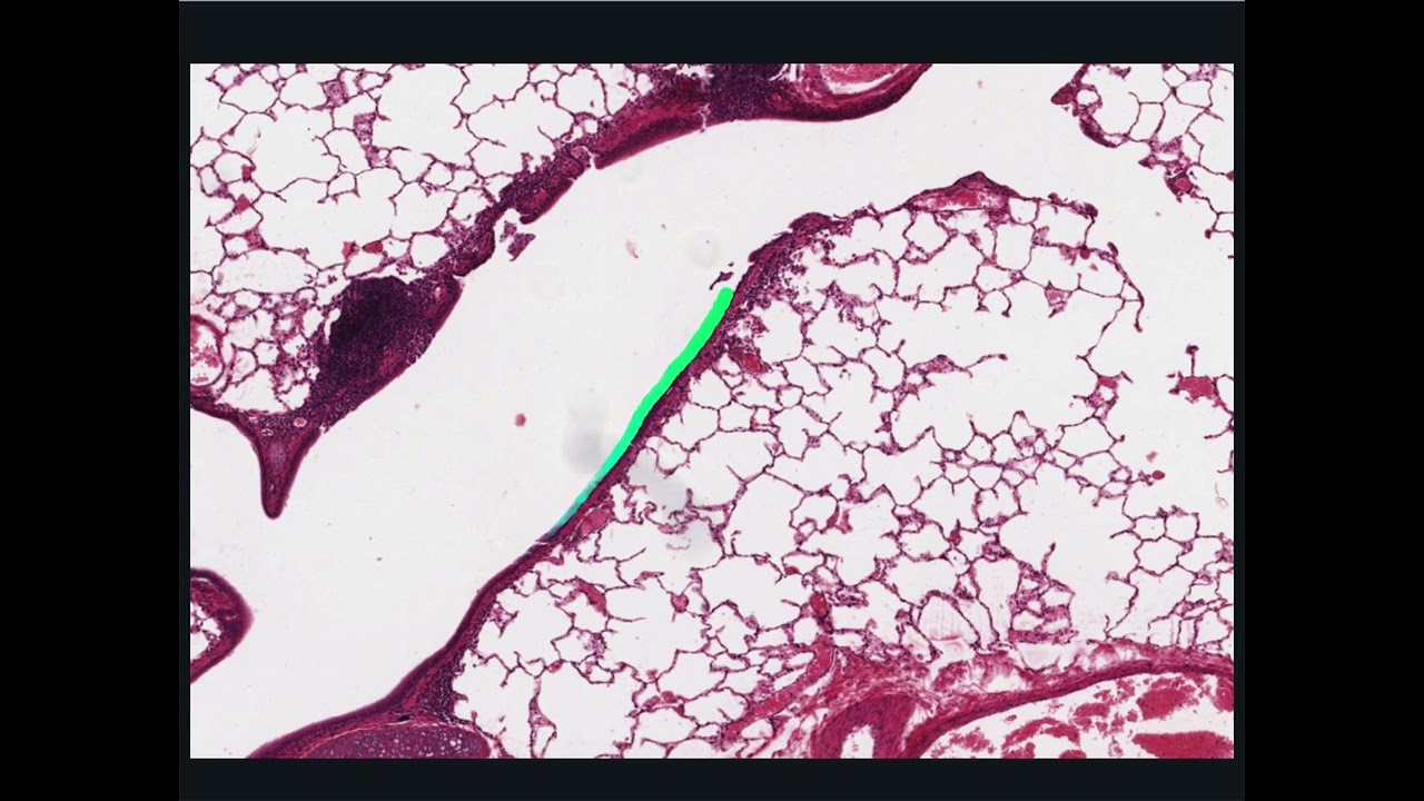 Respiratory System Histology - Lung Acinus